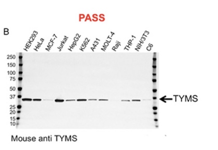 两种抗体的验证数据。A，该碳酸酐酶IX (CA9)小鼠单克隆抗体因非特异性结合和低信噪比而未通过验证;B，该胸腺酸合成酶(TYMS)小鼠单克隆抗体通过验证，具有较高的特异性和敏感性。
