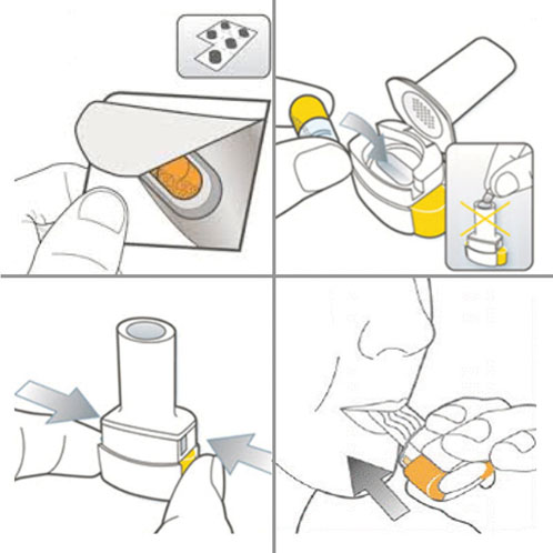 图1:如何使用胶囊吸入器