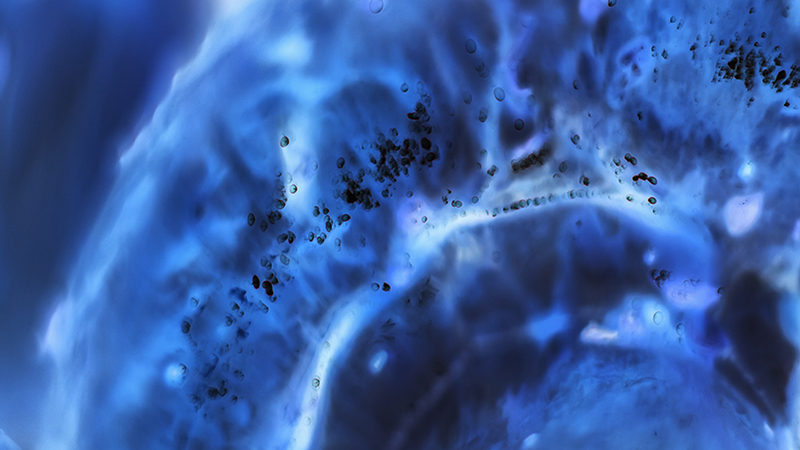 哈佛大学网站上的照片显示显微镜下的癌细胞