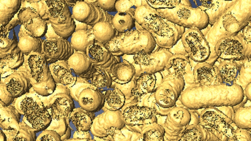 3D渲染图显示了死亡的细菌以及它们被纳米酶吃掉的地方。图片:Chaitali Dekiwadia博士/ RMIT显微镜和微量分析设施